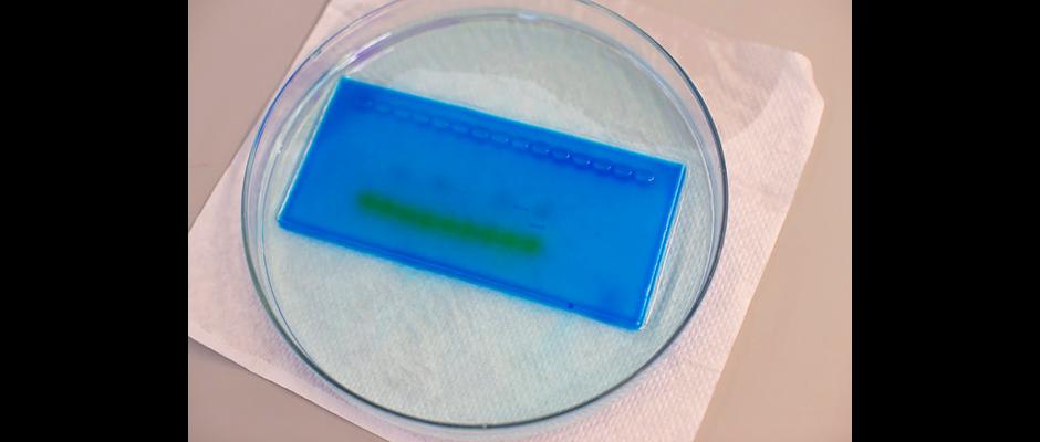 Gel staining result. May 13, 2015. (Photo by Wenshu Li)